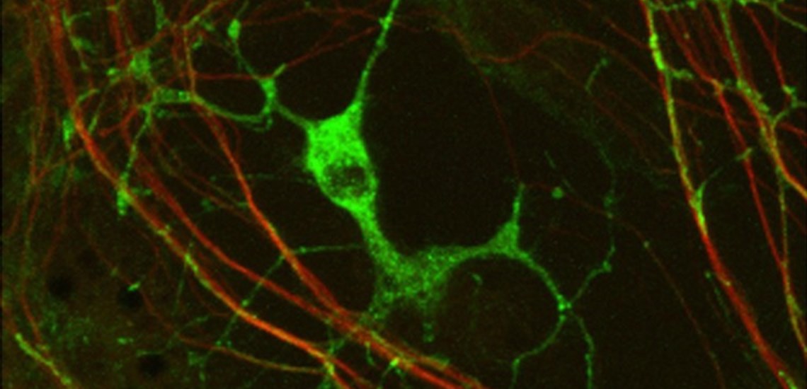 Myelination: oligodendrocyte engaging with neurites