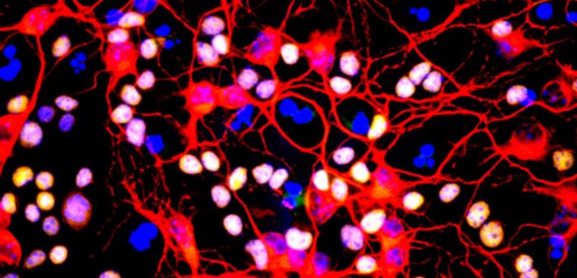 Myelination: oligodendrocyte engaging with neurites